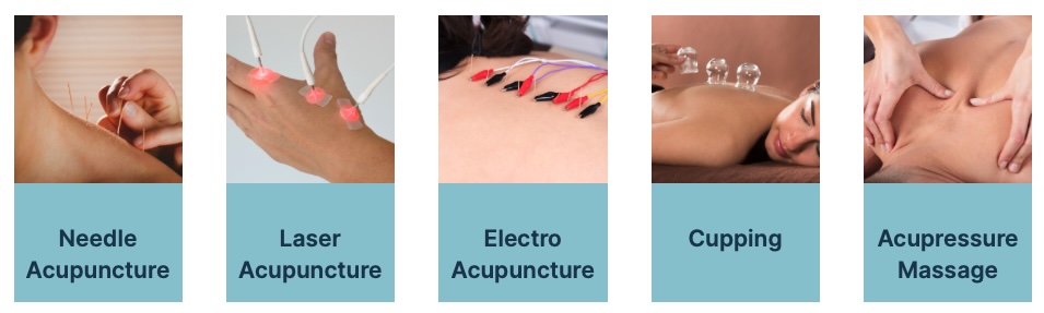 Acupuncture Services - Courtesy of acumedhealth.ca